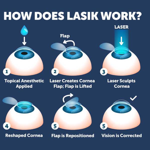 Lasik Refractive Surgery service by Dr. Vidya Bawkar - Cornea Specialist & Opthalmologist in Dombivali, Mumbai